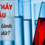 giấc mơ thấy máu FB88