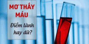 Cược Chấp J88: Tìm Hiểu Về Phương Pháp Cược Được Yêu Thích